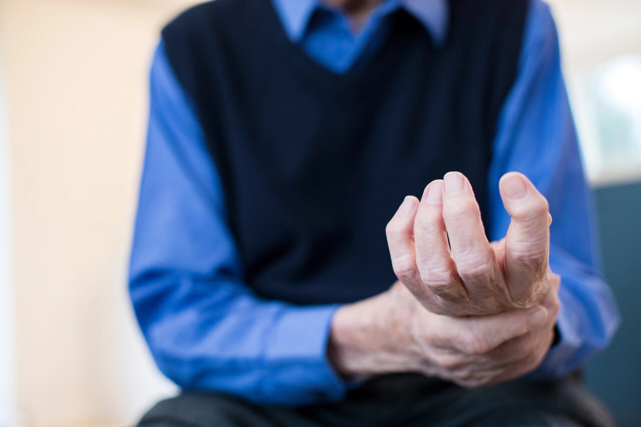 naturopathy for arthritis